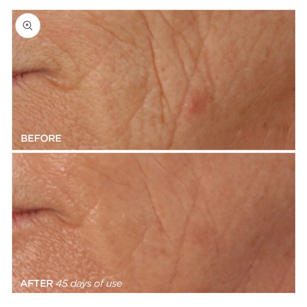 BEAUTYBIO | The Reversal 3 Piece Set - Picture 3 of 7